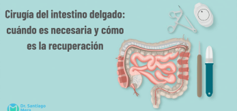 Cirugía del intestino delgado cuándo es necesaria y cómo es la recuperación Málaga