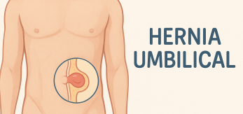 Hernia Umbilical cirujano Málaga