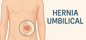Hernia Umbilical cirujano Málaga