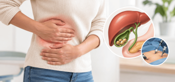 Vesícula biliar y tratamiento colelitiasis Málaga